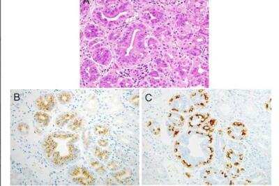 Immunohistochemistry-Paraffin: Pepsinogen I Antibody (8003 (99/12)) - BSA Free [NB100-62239]