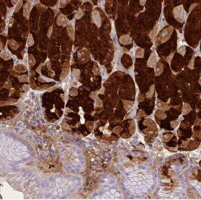 Immunohistochemistry-Paraffin: Pepsinogen I Antibody [NBP2-54730]