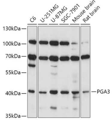 Western Blot: Pepsinogen I AntibodyAzide and BSA Free [NBP2-95099]