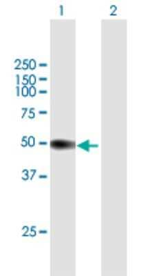 Western Blot: Peptidase Inhibitor 16/PI16 Antibody [H00221476-B01P]