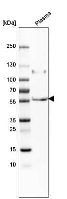 Western Blot: Peptidase Inhibitor 16/PI16 Antibody [NBP1-92254]