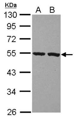 Western Blot: Peptidase Inhibitor 16/PI16 Antibody [NBP2-19772]