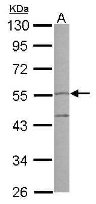 Western Blot: Peptidase Inhibitor 16/PI16 Antibody [NBP2-19773]