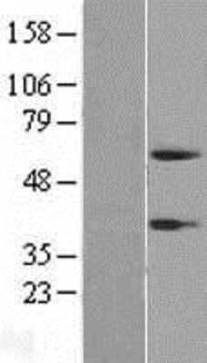 Western Blot: Peptidase Inhibitor 16/PI16 Overexpression Lysate [NBP2-05262]