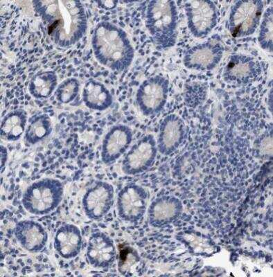 Immunohistochemistry-Paraffin: Peptide YY Antibody (1) - BSA Free [NBP1-05167]