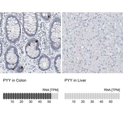 Immunohistochemistry-Paraffin: Peptide YY Antibody [NBP1-80865]