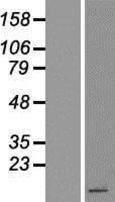 Western Blot: Peptide YY Overexpression Lysate [NBP2-10568]