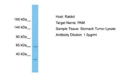 Western Blot: Peptidylglycine alpha-Amidating Monooxygenase/PAM Antibody [NBP2-88035]