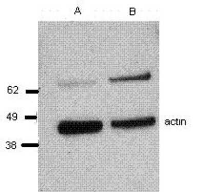 Western Blot: Perforin Antibody (BOR21)BSA Free [NBP1-43106]