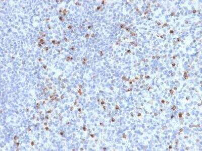 Immunohistochemistry-Paraffin: Perforin Antibody (PRF1/2470) - Azide and BSA Free [NBP2-79886]