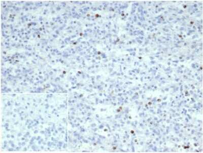 Immunohistochemistry-Paraffin: Perforin Antibody (PRF1/7077R) [NBP3-13751]