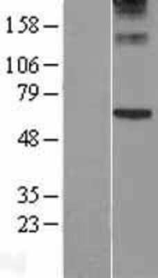 Western Blot: Perforin Overexpression Lysate [NBL1-14750]