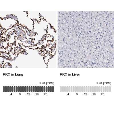 Immunohistochemistry-Paraffin: Periaxin Antibody [NBP1-89598]