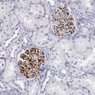 Immunohistochemistry-Paraffin: Periaxin Antibody [NBP1-89598]