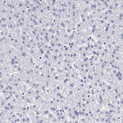 Immunohistochemistry-Paraffin: Periaxin Antibody [NBP1-89598]