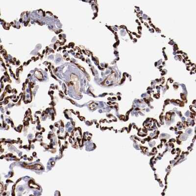 Immunohistochemistry-Paraffin: Periaxin Antibody [NBP1-89598]