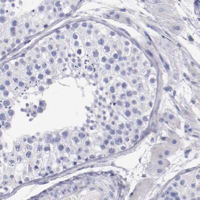 Immunohistochemistry-Paraffin: Periaxin Antibody [NBP1-89598]