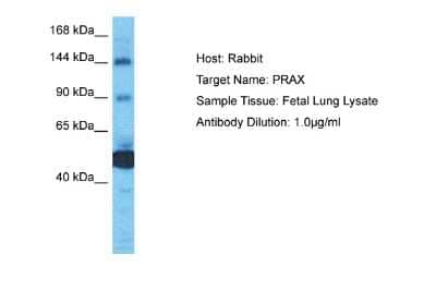 Western Blot: Periaxin Antibody [NBP2-83382]