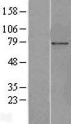 Western Blot: Nucleoporin NUP85 Overexpression Lysate [NBL1-13882]