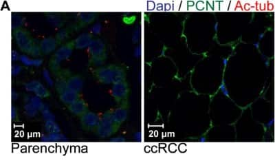 Immunohistochemistry: Pericentrin Antibody [NB100-61071]