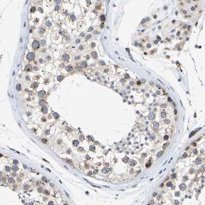 Immunohistochemistry-Paraffin: Pericentrin Antibody [NBP1-87772]
