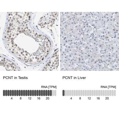 Immunohistochemistry-Paraffin: Pericentrin Antibody [NBP1-87772]