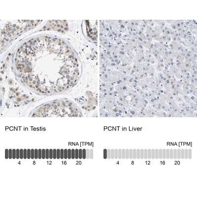 Immunohistochemistry-Paraffin: Pericentrin Antibody [NBP1-87772]