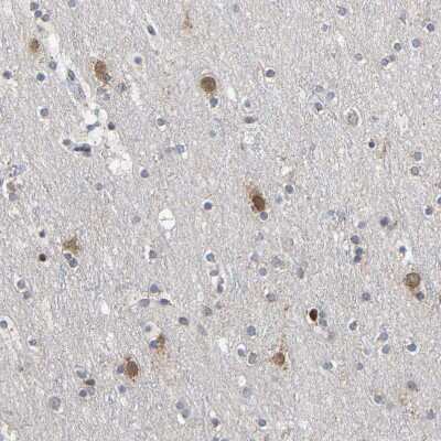Immunohistochemistry-Paraffin: Pericentrin Antibody [NBP1-87772]