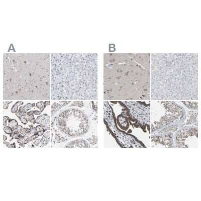 Immunohistochemistry-Paraffin: Pericentrin Antibody [NBP1-87772]