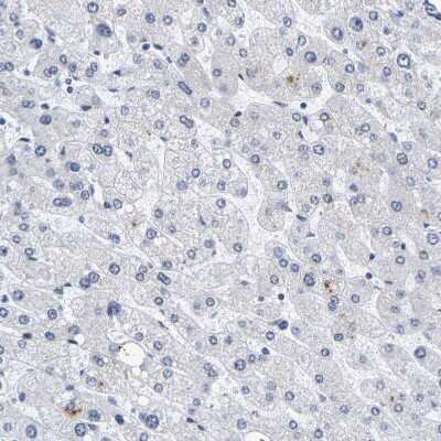 Immunohistochemistry-Paraffin: Pericentrin Antibody [NBP1-87772]