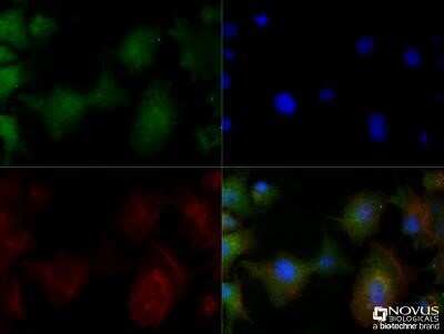Immunocytochemistry/ Immunofluorescence: Perilipin-2/ADFP Antibody (2C5A3) - Azide and BSA Free [NBP2-80907]