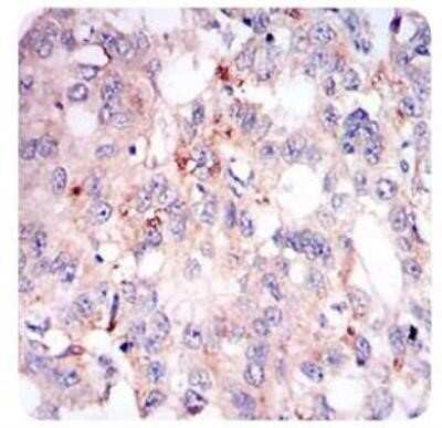 Immunohistochemistry: Perilipin-2/ADFP Antibody (2C5A3) - Azide and BSA Free [NBP2-80907]