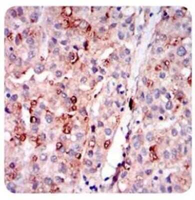 Immunohistochemistry-Paraffin: Perilipin-2/ADFP Antibody (2C5A3) - Azide and BSA Free [NBP2-80907]