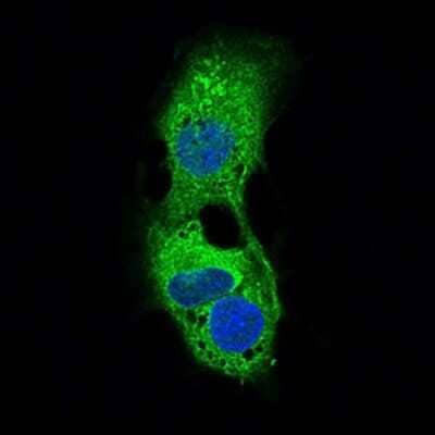 Immunocytochemistry/ Immunofluorescence: Perilipin-2/ADFP Antibody (2C5H8) - BSA Free [NBP2-37300]