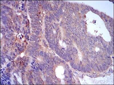 Immunohistochemistry-Paraffin: Perilipin-2/ADFP Antibody (2C5H8) - BSA Free [NBP2-37300]