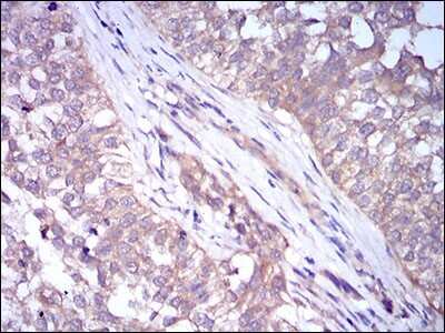 Immunohistochemistry-Paraffin: Perilipin-2/ADFP Antibody (2C5H8) - BSA Free [NBP2-37300]