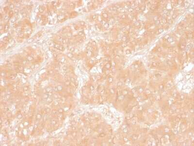 Immunohistochemistry-Paraffin: Perilipin-2/ADFP Antibody (ADFP/1366) - Azide and BSA Free [NBP2-54313]