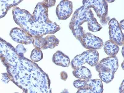 Immunohistochemistry-Paraffin: Perilipin-2/ADFP Antibody (ADFP/1493) [NBP2-53406]