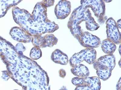 Immunohistochemistry-Paraffin: Perilipin-2/ADFP Antibody (ADFP/1493) - Azide and BSA Free [NBP2-54312]