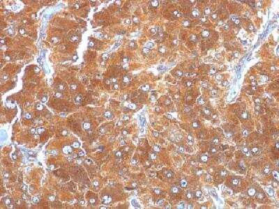 Immunohistochemistry-Paraffin: Perilipin-2/ADFP Antibody (ADFP/1494) - Azide and BSA Free [NBP2-54598]