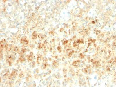 Immunohistochemistry-Paraffin: Perilipin-2/ADFP Antibody (ADFP/2755R) [NBP3-07883]