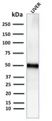 Western Blot: Perilipin-2/ADFP Antibody (ADFP/2755R) [NBP3-07883]