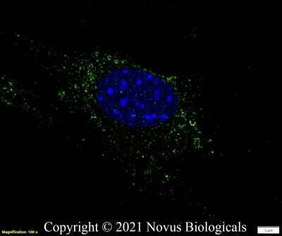 Immunocytochemistry/Immunofluorescence Staining of Perilipin-2/ADFP in NIH3T3 Cells