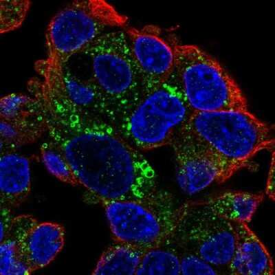 Immunocytochemistry/ Immunofluorescence: Perilipin-2/ADFP Antibody [NBP2-48532]