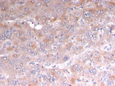 Immunohistochemistry-Paraffin: Perilipin-2/ADFP Antibody (rADFP/1493) - Azide and BSA Free [NBP3-08453]