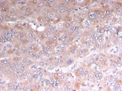 Immunohistochemistry-Paraffin: Perilipin-2/ADFP Antibody (rADFP/1493) [NBP3-07882]