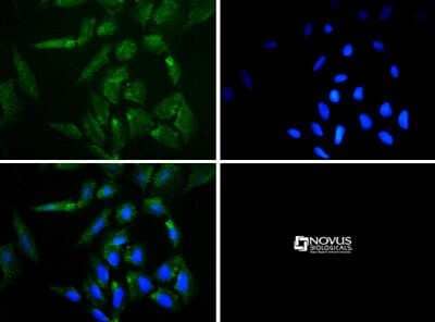 Immunocytochemistry/ Immunofluorescence: Perilipin-3/TIP47 Antibody [NB110-40764]