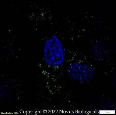 Immunocytochemistry/ Immunofluorescence: Perilipin-3/TIP47 Antibody [NB110-40764]