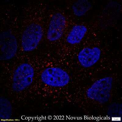 Immunocytochemistry/ Immunofluorescence: Perilipin-3/TIP47 Antibody [NB110-40764]