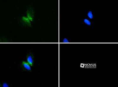 Immunocytochemistry/ Immunofluorescence: Perilipin-3/TIP47 Antibody [NB110-40765]